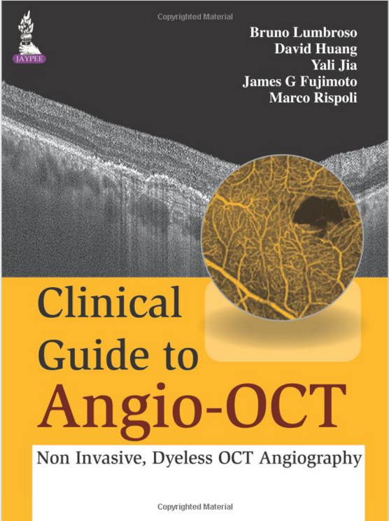 Clinical Guide to Angio-OCT: Non Invasive, Dyeless OCT Angiography
