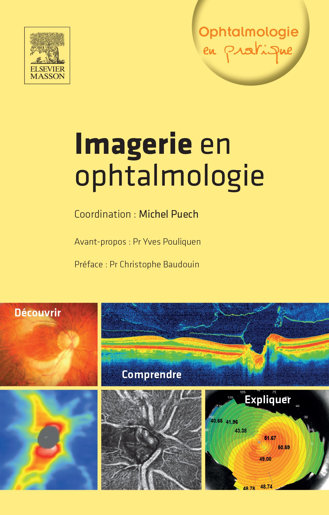 Imagerie en ophtalmologie 🇫🇷