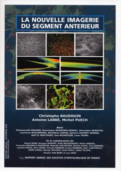 La Nouvelle Imagerie du Segment Antérieur BSOF 2009 🇫🇷